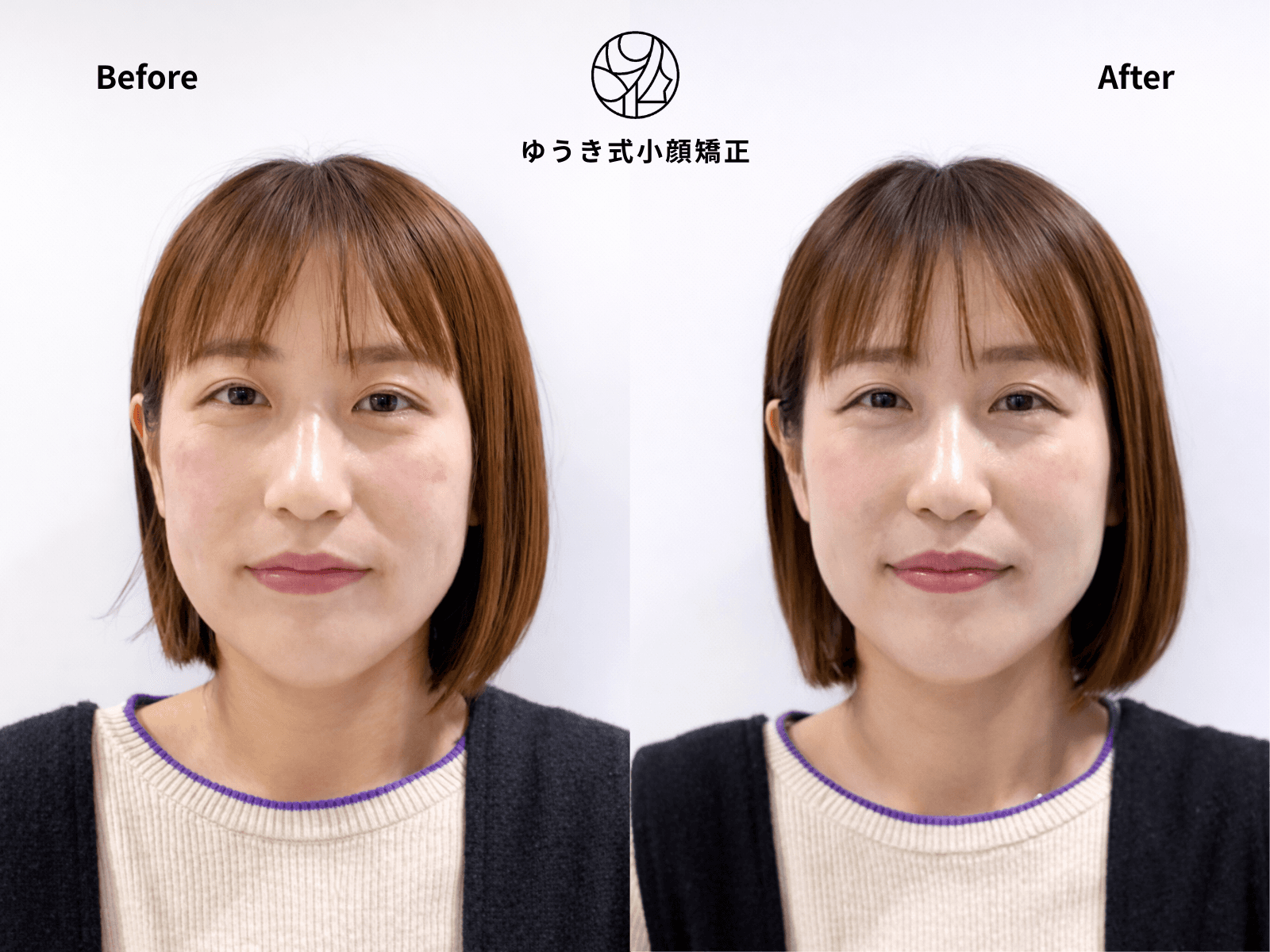 40代女性 年齢と共に顔が変化してきた Before/After